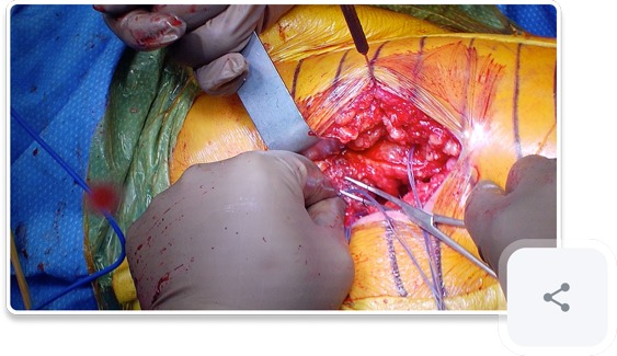 Share videos of surgery